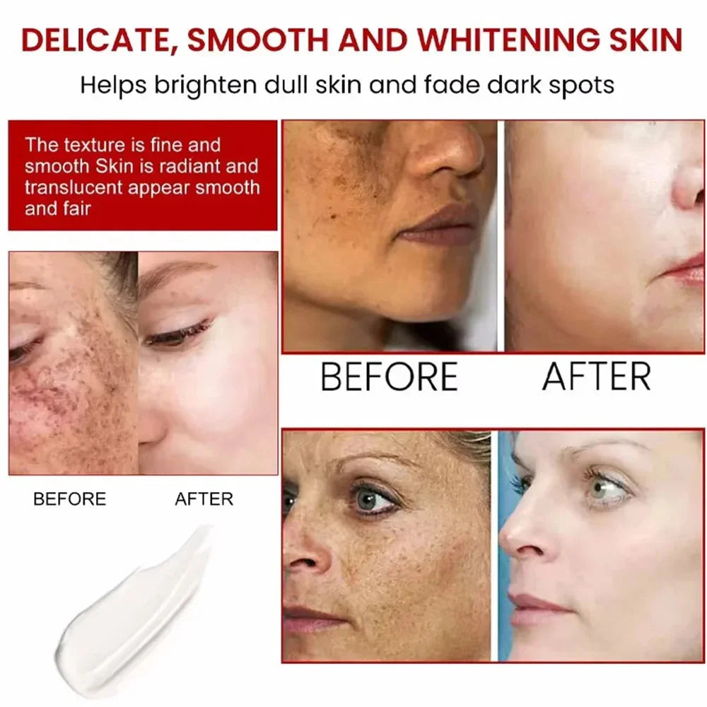 Powerful Spot-Removing Whiten Cream Brighten Skin Fast Eliminates Melanin Pigmentation Melasma Dark Spots Korean Face Skin Care