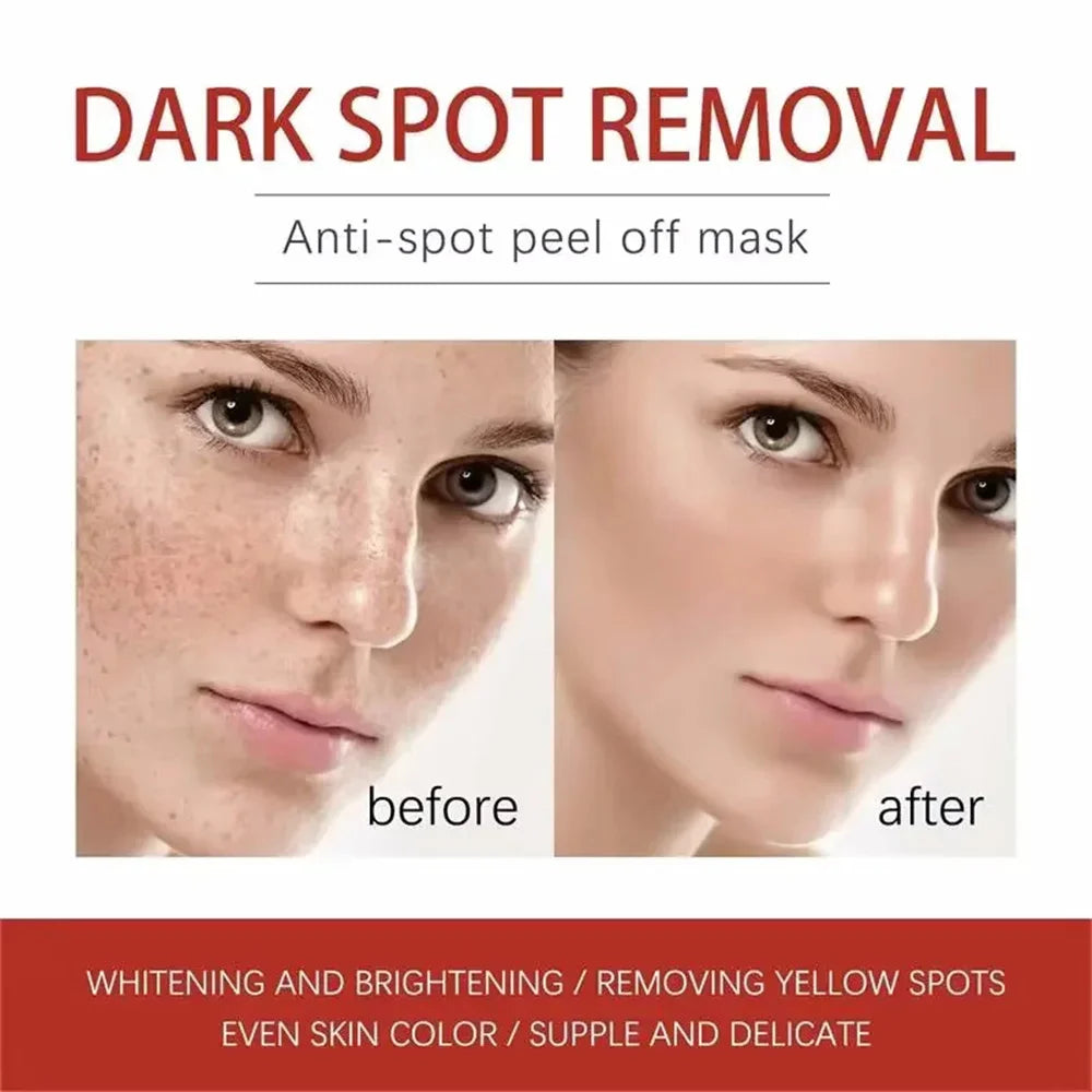 Powerful Spot-Removing Whiten Cream Brighten Skin Fast Eliminates Melanin Pigmentation Melasma Dark Spots Korean Face Skin Care