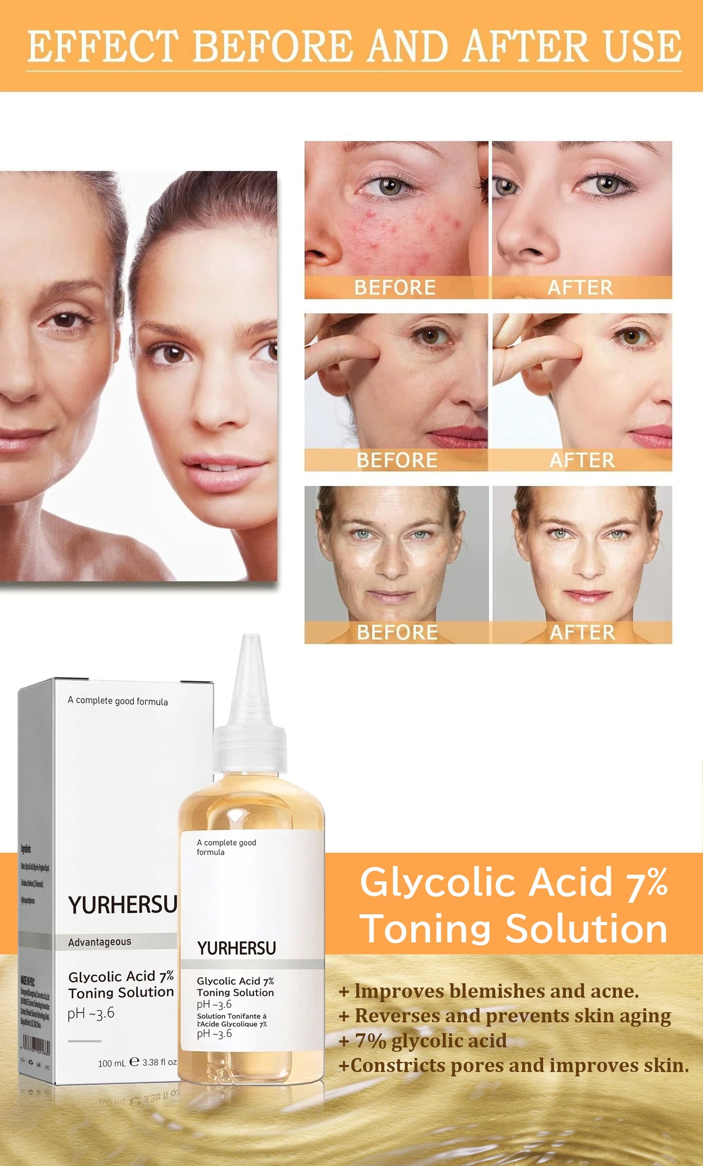 Glycolic Acid 7% Toner Gentle formula, nourishes and moisturizes skin, refreshing and non-sticky.