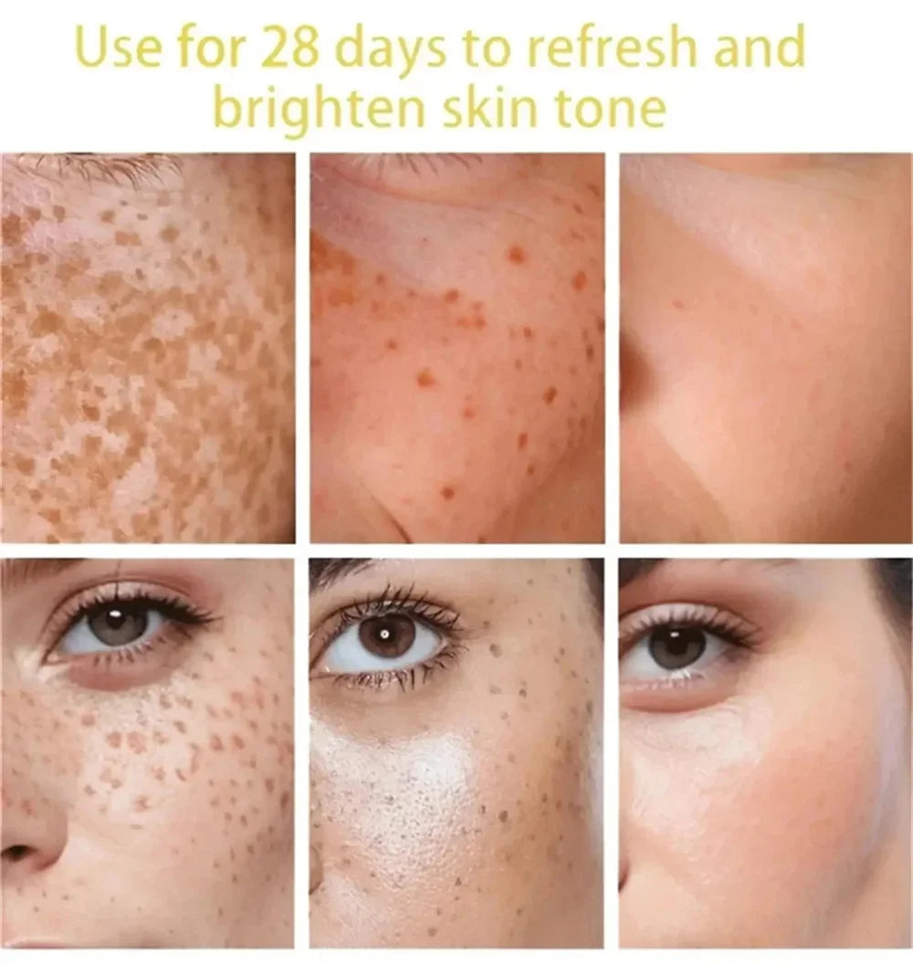 Powerful Spot-Removing Whiten Cream Brighten Skin Fast Eliminates Melanin Pigmentation Melasma Dark Spots Korean Face Skin Care