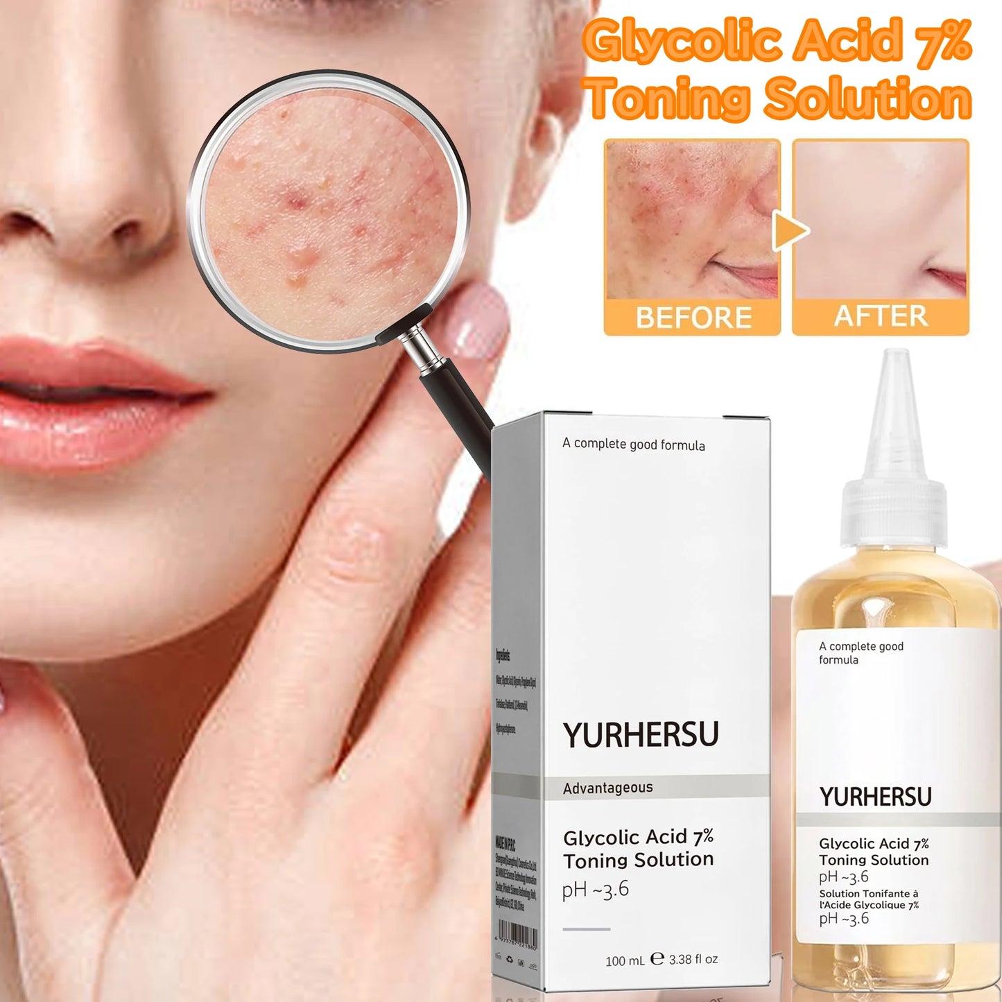 Glycolic Acid 7% Toner Gentle formula, nourishes and moisturizes skin, refreshing and non-sticky.