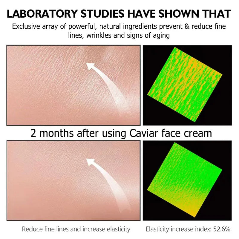 Caviar Collagen Cream Moisturizer Anti Wrinkle Lifting Firming Face Wrinkle Cream Brighten Korean Skin Care Product