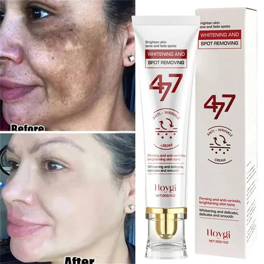 Powerful Spot-Removing Whiten Cream Brighten Skin Fast Eliminates Melanin Pigmentation Melasma Dark Spots Korean Face Skin Care